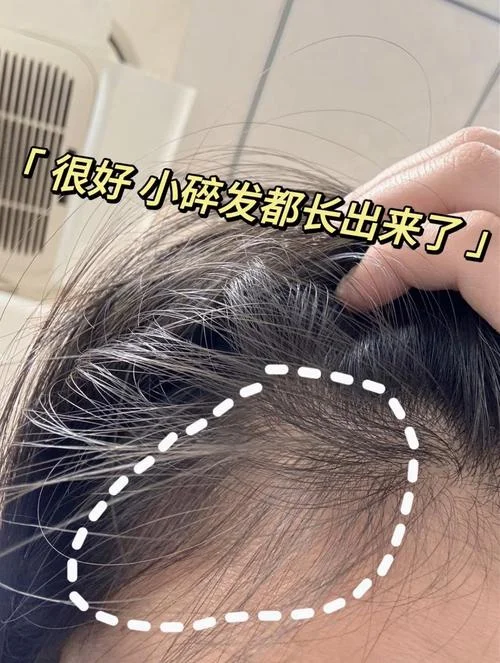女人梦到自己头发长了_1