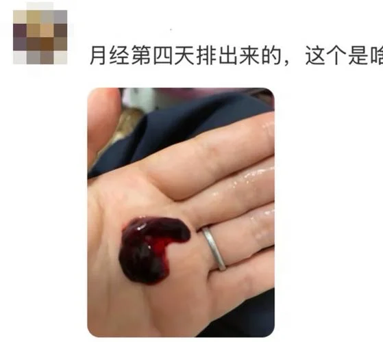 做梦来例假大出血-梦遗经大出血