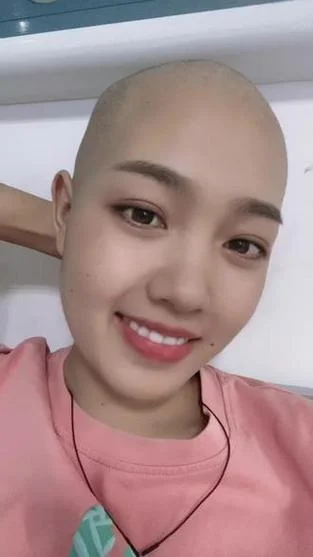 梦见女儿剃成光头了_1