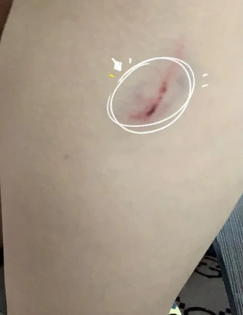 梦见狗咬我大腿但是没有流血_1