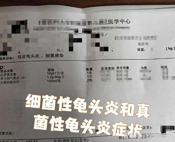 什么是霉菌包皮龟头炎图片_1
