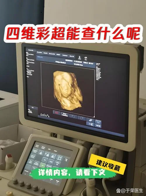 如何查胎儿是否畸形-胎儿畸形筛查