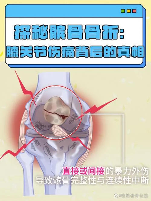 膝盖以下的骨头叫什么_1
