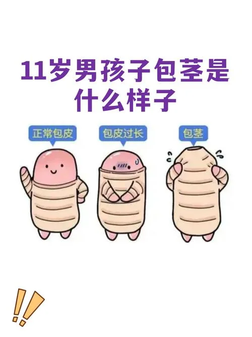 小男孩阴茎发育不良怎么办-