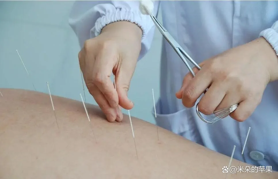 针灸推拿学考研考什么_1