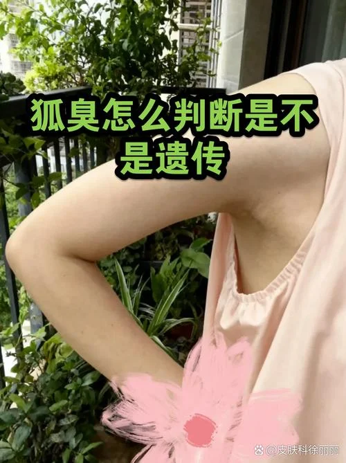 几月怀孕不会遗传狐臭_1
