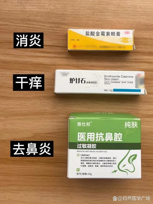 鼻炎买什么药好_2