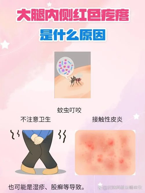 竹席虫子咬了怎么办-竹席虫咬如何防？