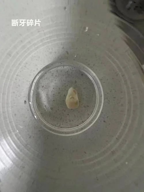 梦见门牙破了一小块-梦见门牙缺一块