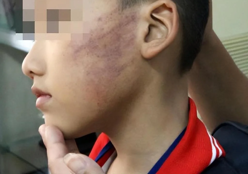 梦见被打耳光-梦见被打耳光