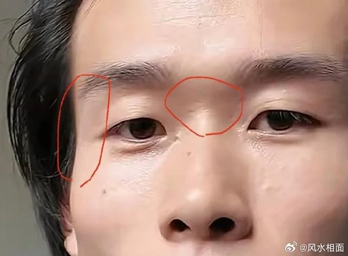 男人两边腮骨突出面相-男人两侧腮骨突出面相
