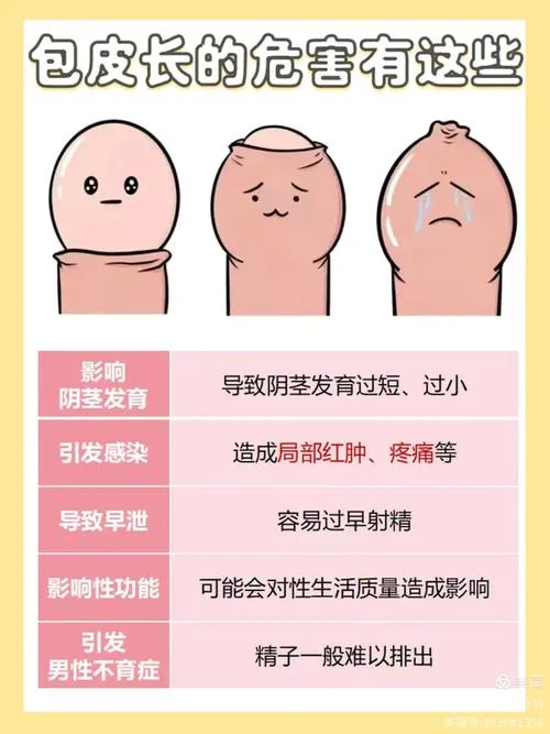 包皮过长大概多少钱-包皮过长费用多少