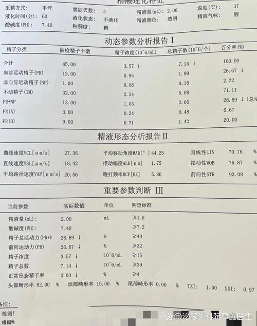 如何查精液_1