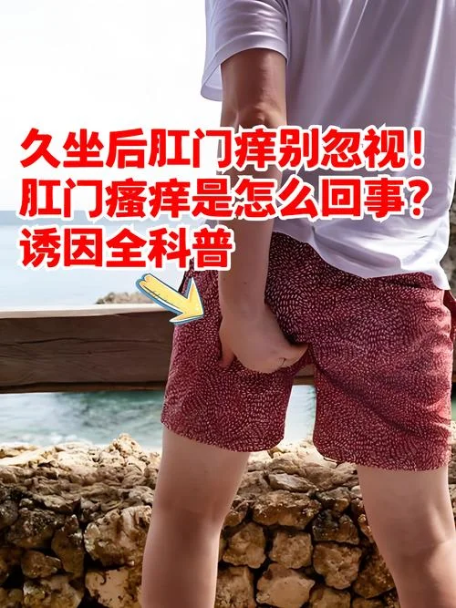 肛门刺痒怎么办-肛门刺痒需缓解