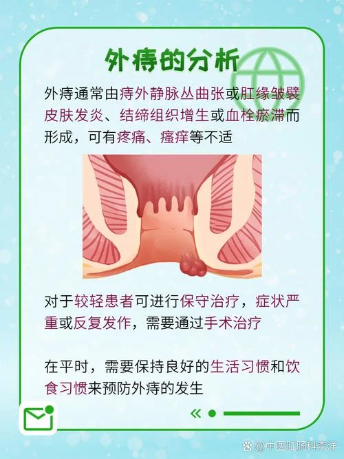 什么是外痔是癌症_2