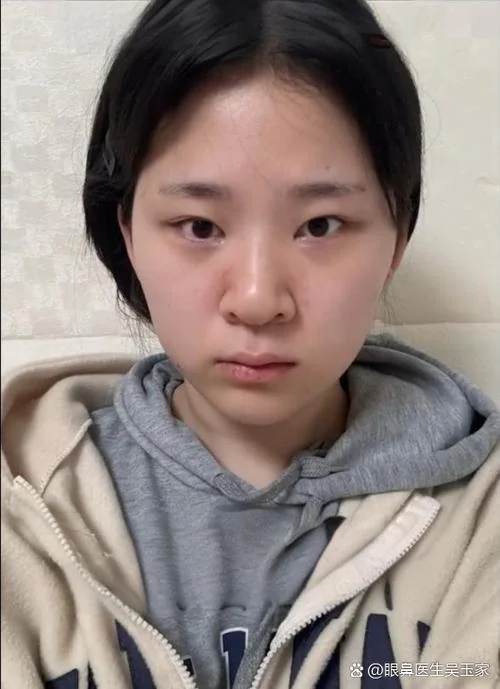 女生大鼻子面相好吗-女大鼻子面相好