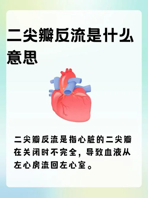 二尖瓣少量返流什么意思_2