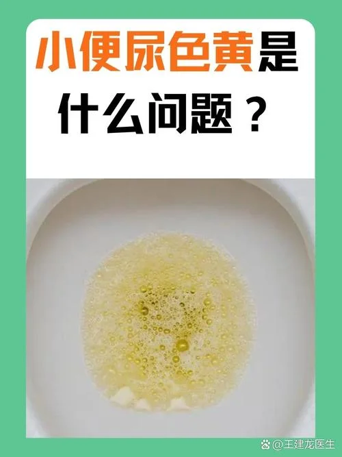 为什么尿尿是很黄很黄的_2