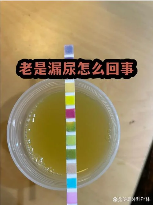 尿失禁是什么意思_2