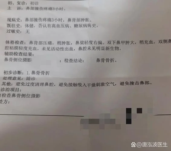 鼻梁摔歪了怎么办_2