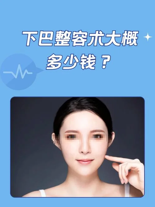 整容大概花多少钱呢-整容大概花费多少