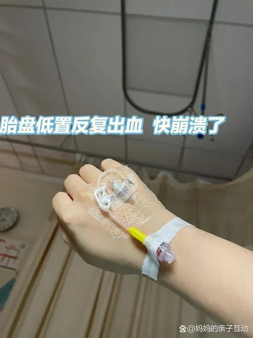 做梦梦到自己流血保胎_2