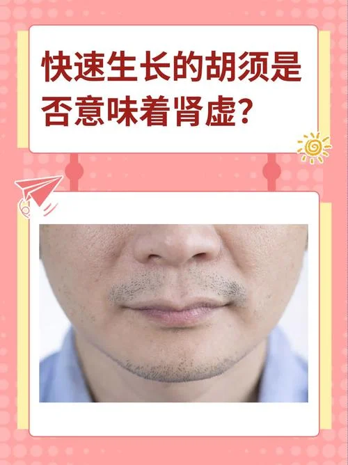 梦见自己长胡子是什么意思-梦见长胡子的寓意