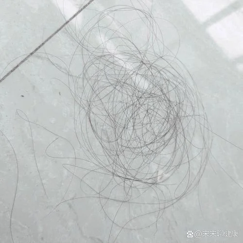 梦见自己掉很多头发-梦见大量脱发