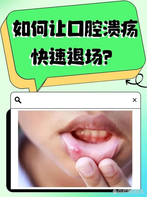 嘴巴老口腔溃疡怎么办-口腔溃疡老怎么办