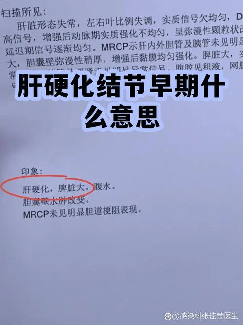 肝内结节是指什么意思_1