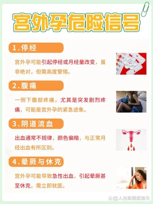 什么是宫外孕宫外孕一般多久能发现_2