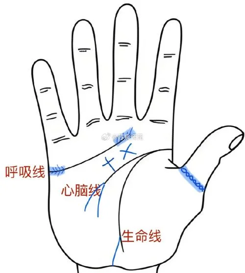手相智慧线交叉-手相智慧线交叉