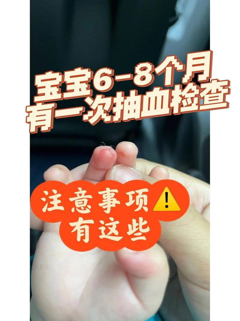 宝宝六个月体检项目_1
