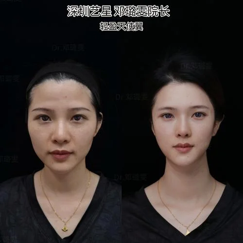 额头有龙骨面相怎么样_1