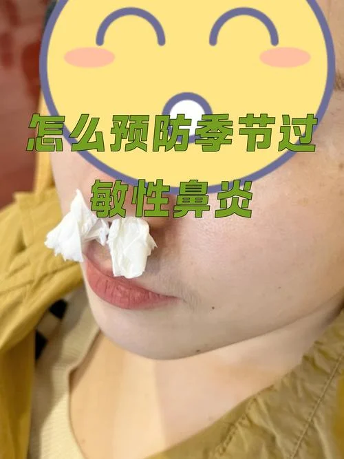 过敏性鼻炎几月结束_1