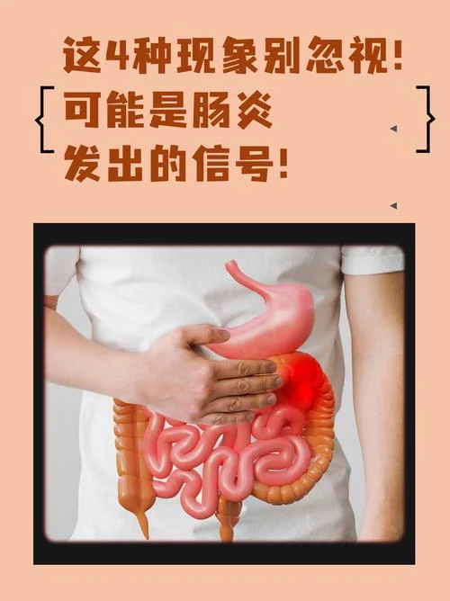 什么是慢性肠炎症状_2
