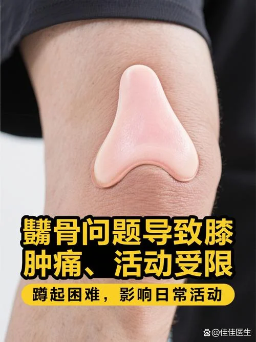 膝盖以下的骨头叫什么_2