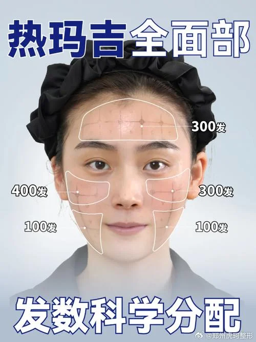 热玛吉是哪年出现的_1