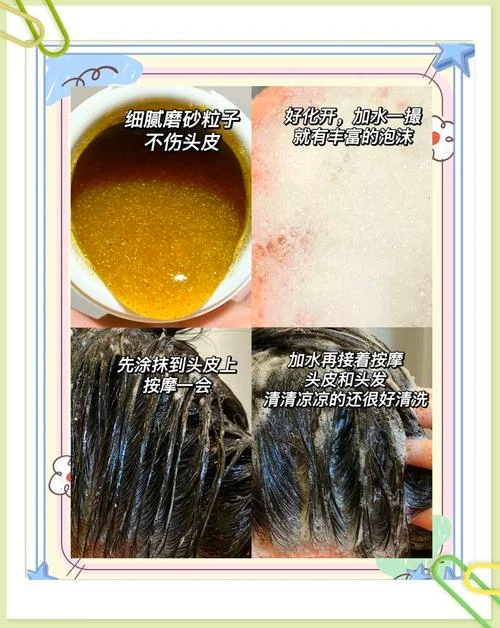 头皮干痒怎么办_2