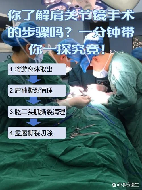 外科手术式打击出处_1