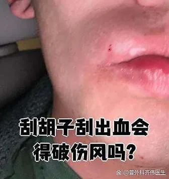 梦见刮胡子刮了一半-梦见刮胡子留半截