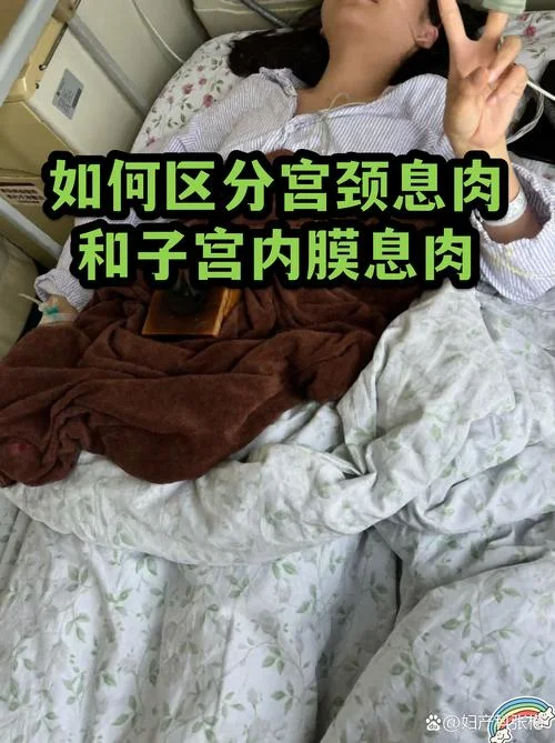 如何查子宫内膜息肉_1