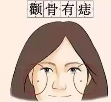 右边颧骨有痣女人面相_2