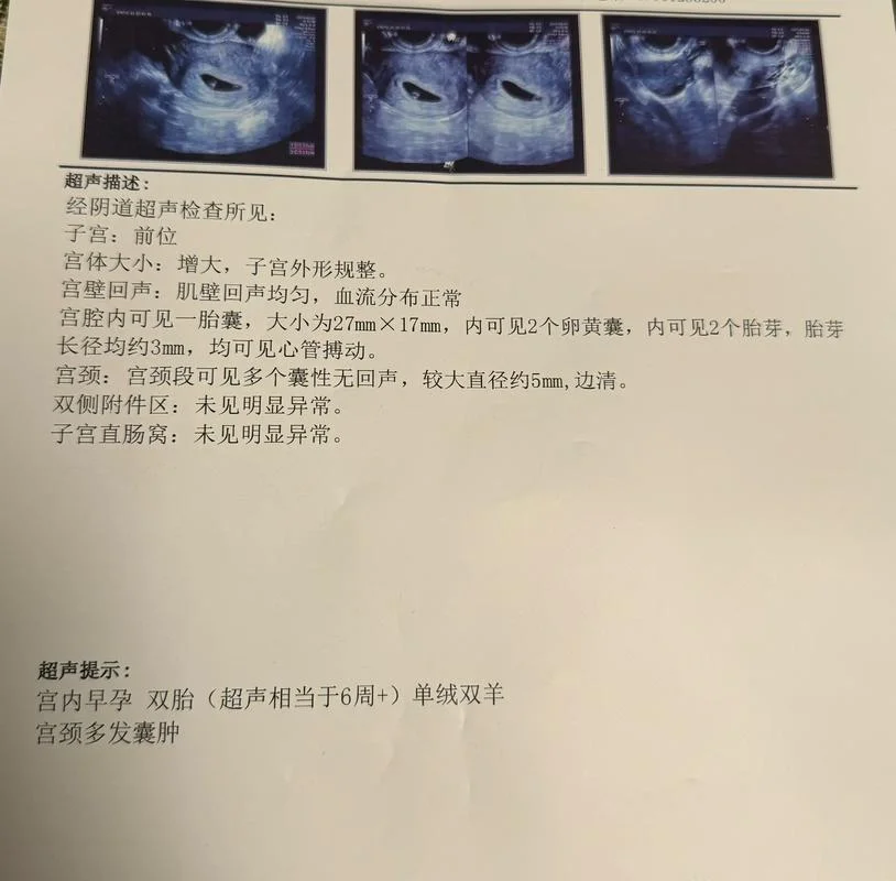 梦见生一对双胞胎儿子_2