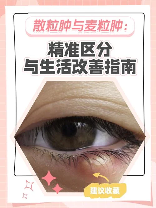 眼睑是读什么-眼睑读什么