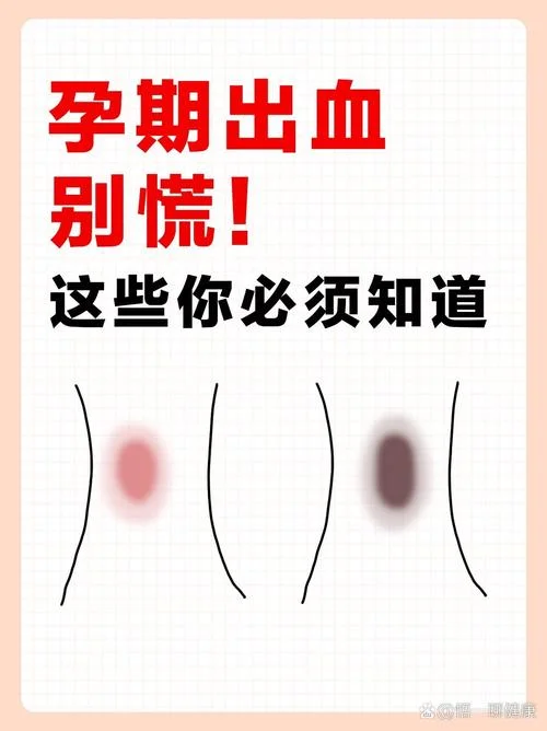 孕妇梦见自已流血_1