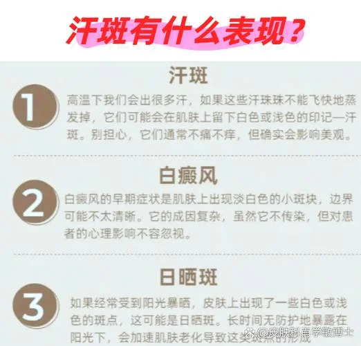 脸上圆形斑叫什么斑_2