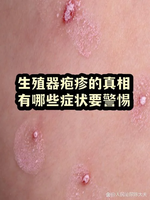 最新病毒感染什么症状-最新病毒感染症状