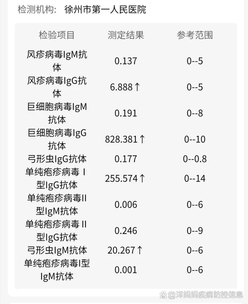 做弓形虫检查多少钱-弓形虫检查费用