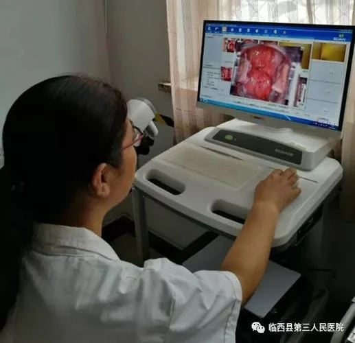 医生要求做阴道镜十活检是么回事_1